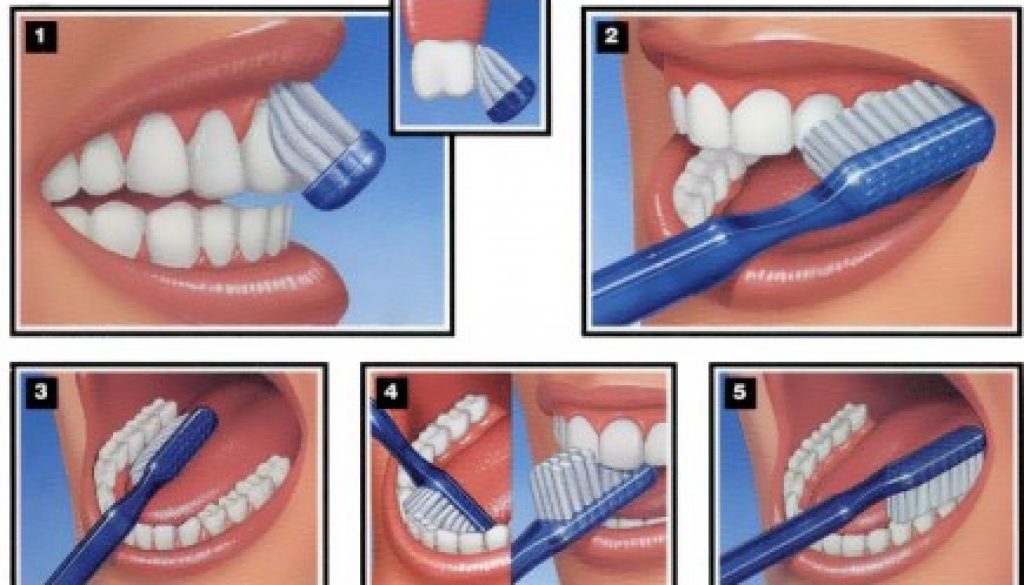Những điều cần biết về bàn chải đánh răng của bạn